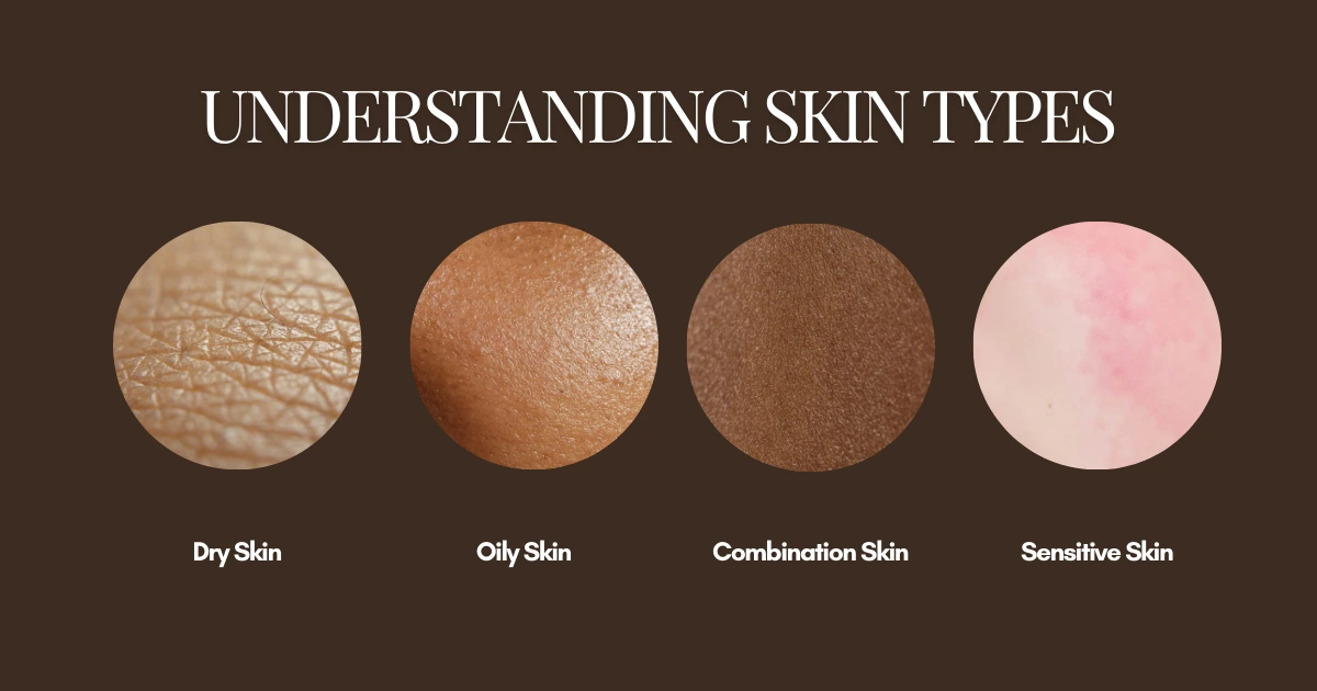 identify your skim type